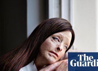 Image of burn survivor wins Taylor Wessing photo portrait prize | Taylor Wessing photographic portrait prize